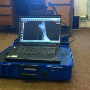 BCF Tru-DR poprtable digital X-ray system